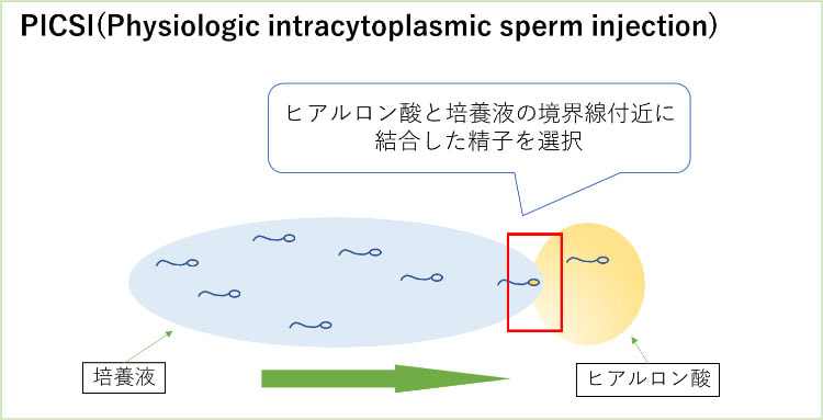 PICSI（ヒアルロン酸を用いた生理学的精子選択術）