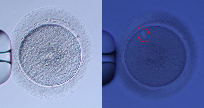 紡錘体観察顕微授精