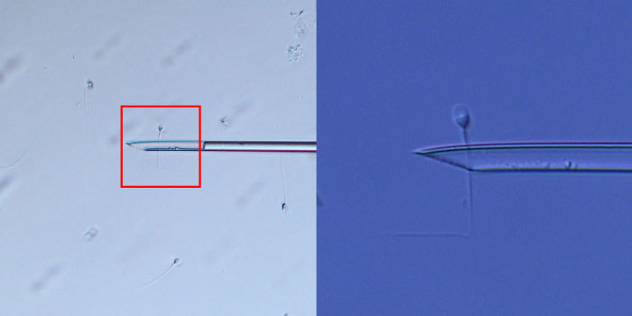 IMSI（強拡大顕微鏡）での選別作業